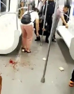 应该砸你嘴！